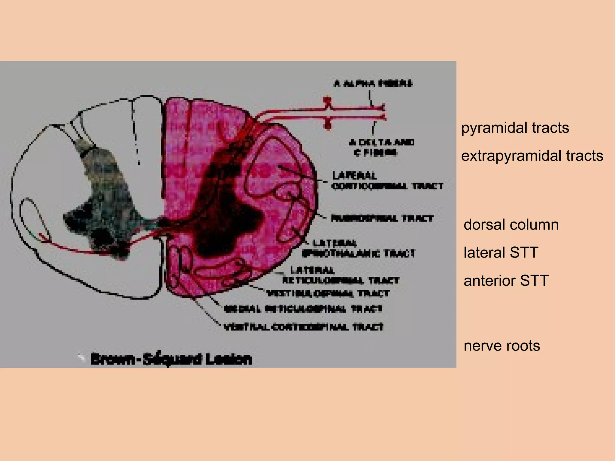 dorsal column lateral STT anterior STT pyramidal tracts extrapyramidal tracts nerve roots 