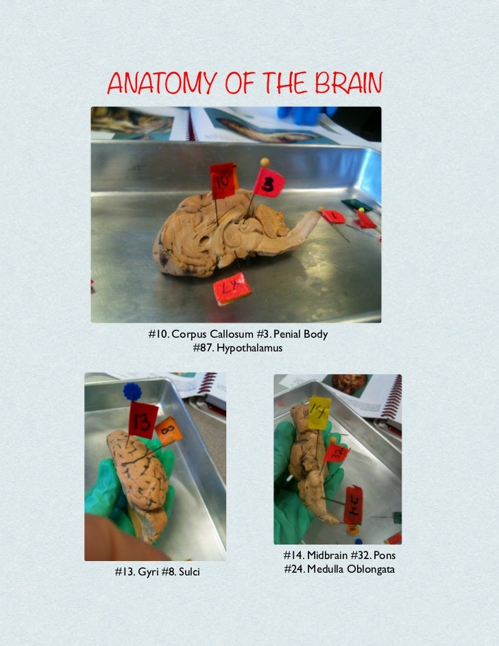 Anatomy of a sheep brain
