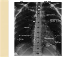 Anatomy of back | PPT