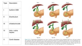 Caroli Types Comprehensive Anatomy and Congenital Anomalies of the Biliary System | PPTX