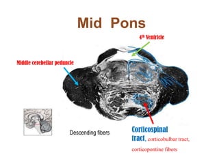 Medial, lateral and superior vestibular</li></ul>nuclei of CN 8<br />• Receive proprioceptive input from vestibular<br />s...
