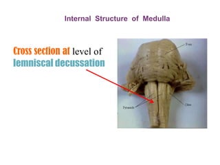 Medulla is broad above ,joins with pons</li></ul>    narrow below, continous with spinal cord<br /><ul><li>Length is about...