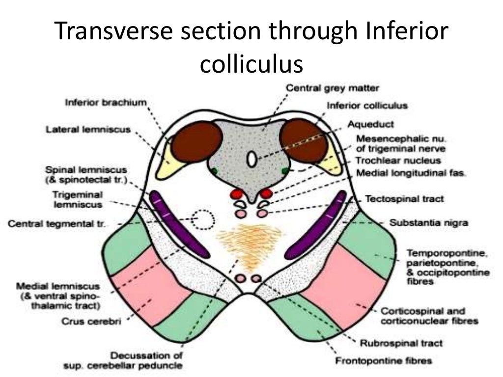 Anatomy of brainstem and its clinical significance