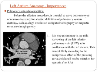 Left Ssv Rfa Anatomy of cardiac structures & conducting system in | PPT