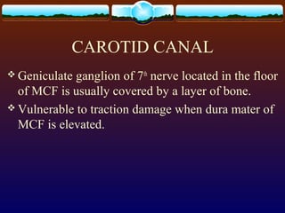 CAROTID CANAL
 Geniculate ganglion of 7th
nerve located in the floor
of MCF is usually covered by a layer of bone.
 Vulnerable to traction damage when dura mater of
MCF is elevated.
 