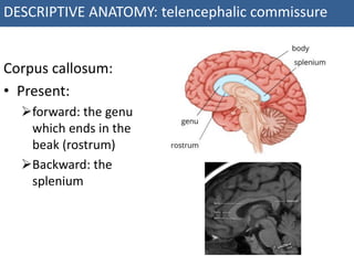 ANATOMY+OF+CEREBRUM.pdf ANATOMY+OF+CEREBRUM.pdf