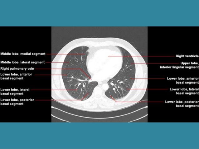 Anatomy of chest