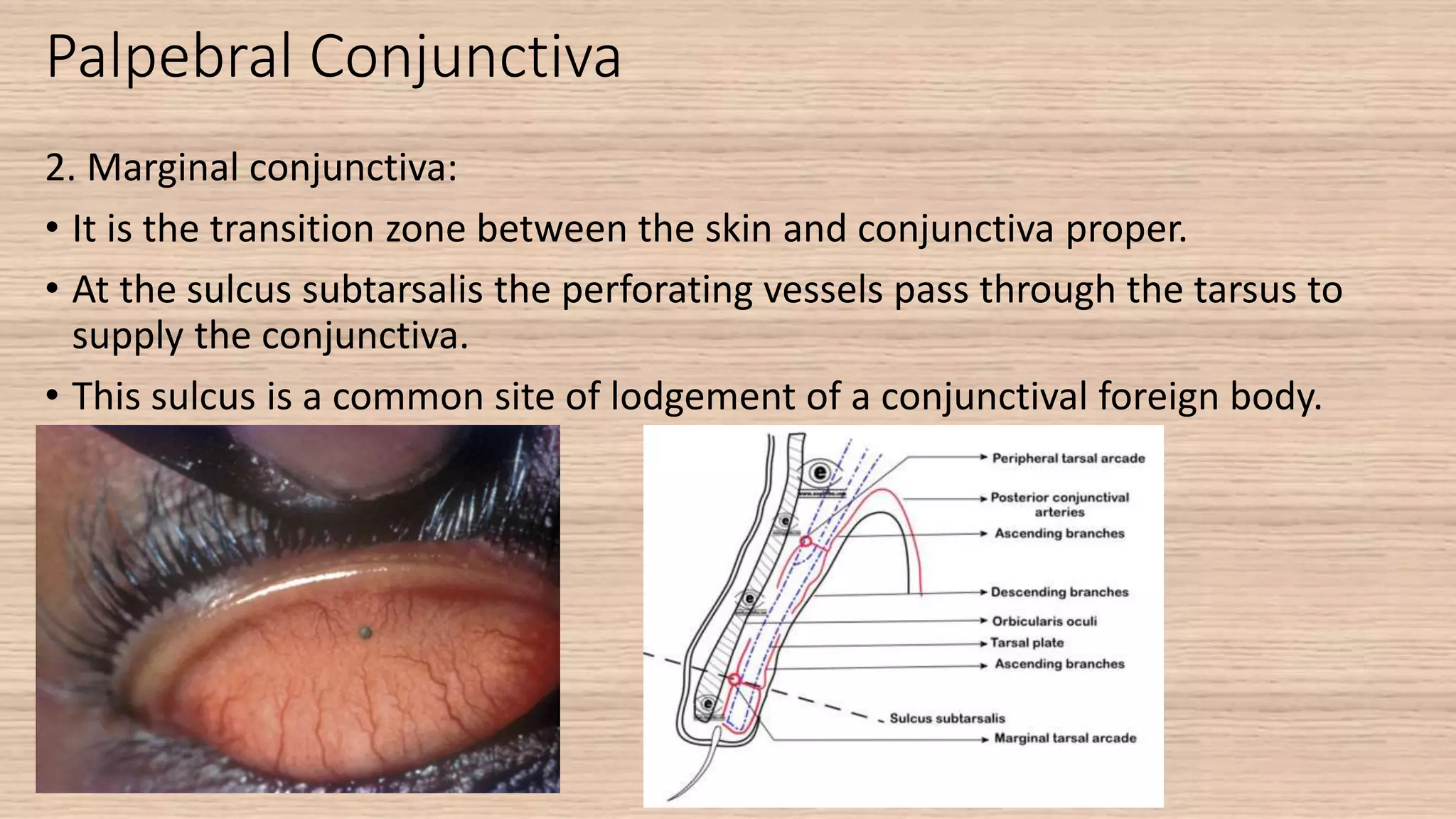 Anatomy Of Conjunctiva pptx Anatomy Of Conjunctiva pptx