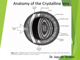 Dr. Aayush Tandon
Anatomy of the Crystalline lens
 