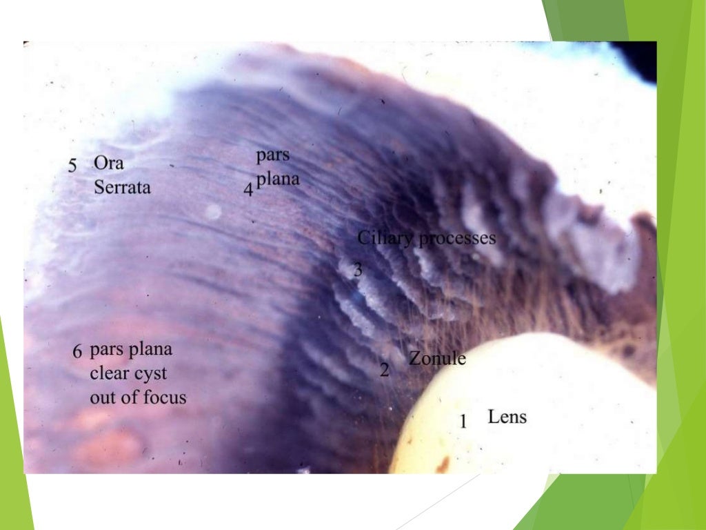 Anatomy Of Crystalline Lens By Dr Aayush Tandon