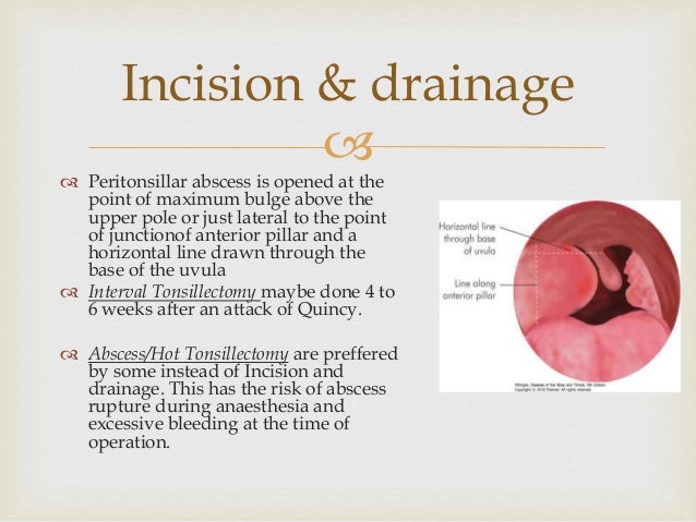 SURGICAL ANATOMY OF DEEP NECK SPACES