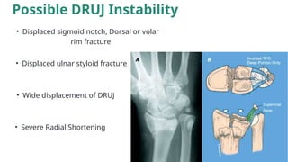 Anatomy Of Distal Radioulnar Joint And Its Function PPTX anatomy-of-distal-radioulnar-joint-and-its-function-pptx