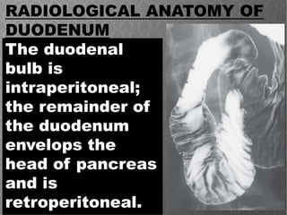 The duodenal
bulb is
intraperitoneal;
the remainder of
the duodenum
envelops the
head of pancreas
and is
retroperitoneal.
RADIOLOGICAL ANATOMY OF
DUODENUM
 