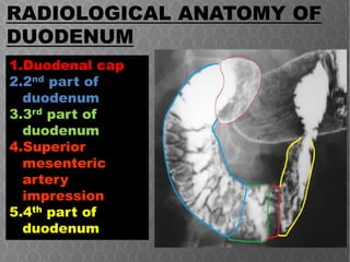 Anatomy of duodenum | PPT