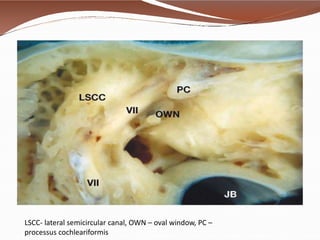Anatomy of ear by dr. bomkar bam (MS) ent | PPTX