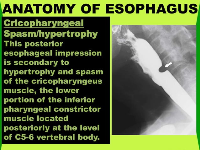 Anatomy of esophagus | PPTX