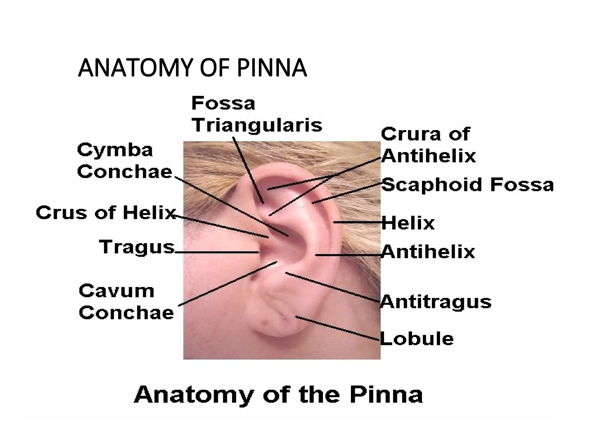 Positioning Pinna Anatomy Of External And Middle Ear .ppt