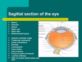  Retina
 Choroid
 Sclera
 Optic cup
 Optic disc
 Subarachnoid space
 Anterior chamber angle
 Trabecular meshwork
 Canal of Schlemm
 Zonules
 Lenscapsule
 Lens cortex
 Lens nucleus
 Fovea at centre of macula
 Lamina cribrosa
 Path of central retinal artery and
vein
Sagittal section of the eye
 