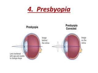 ANATOMY OF EYE n.pdf