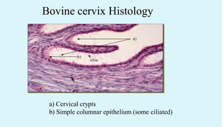 Bovine cervix Histology
a) Cervical crypts
b) Simple columnar epithelium (some ciliated)
 