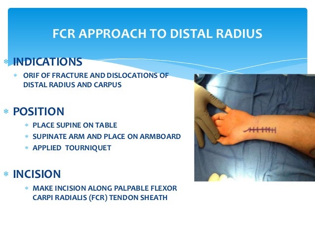 Anatomy Of Forearm