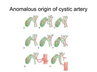 Anomalous origin of cystic artery
 