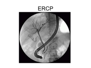 ERCP
 