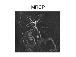 MRCP
 