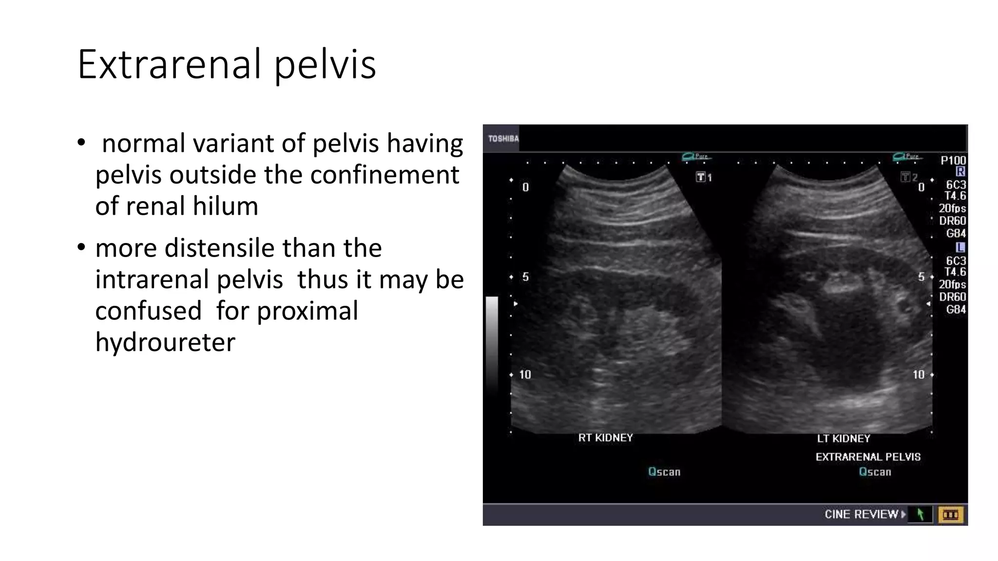 Anatomy of genitourinary system | PPTX