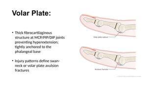 Pip Volar Injection ANATOMY OF HAND and the basics in play surgery | PPTX