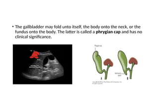 Folded Over Gallbladder Anatomy of hepatobillary system dr avinash with cbd.pptx