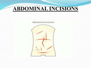 anatomy of inguinal canal and abdominal incisions | PPTX