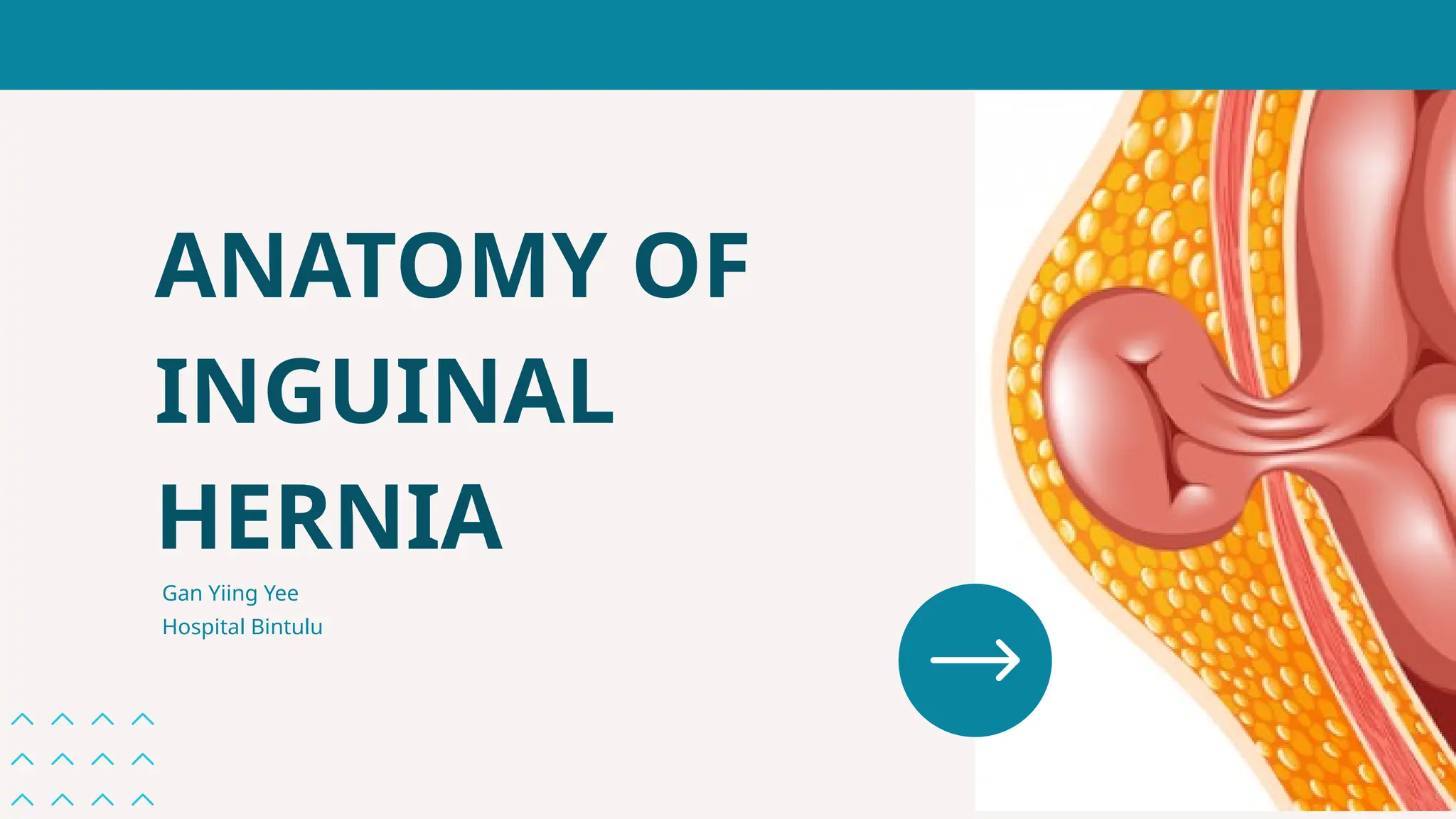 Introduction to anatomy of inguinal hernia | PPTX