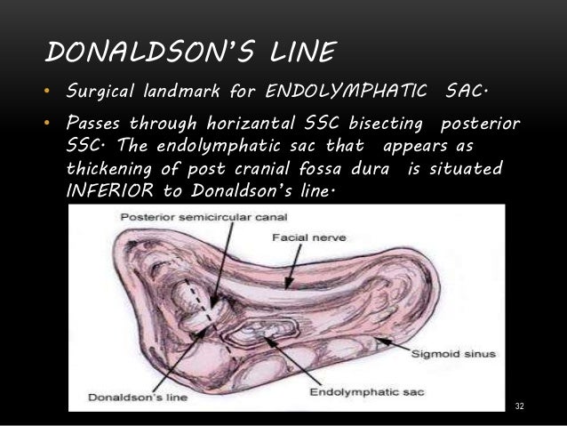 Anatomy of Inner Ear -Dr. Ashly Alexander