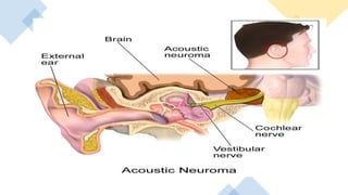 Anatomy of inner ear dr. faisal rahman | PPTX