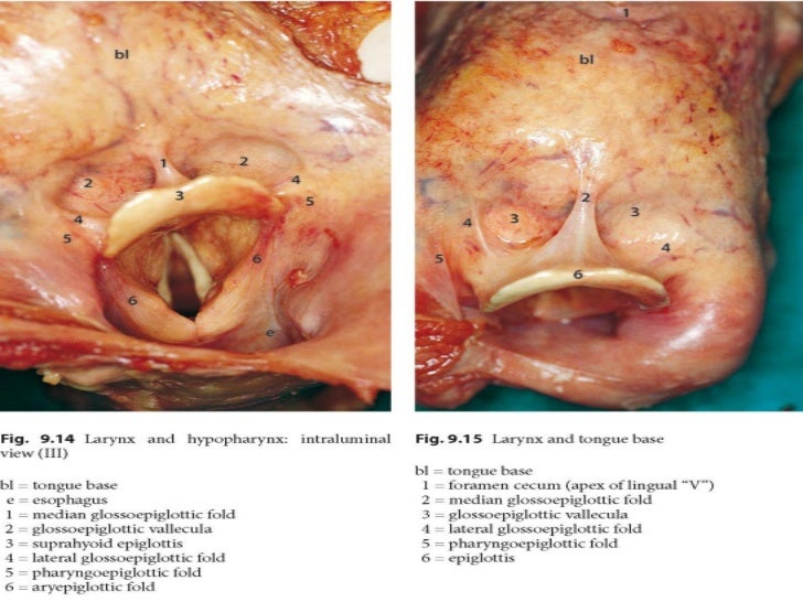 Anatomy of larynx and trachea final