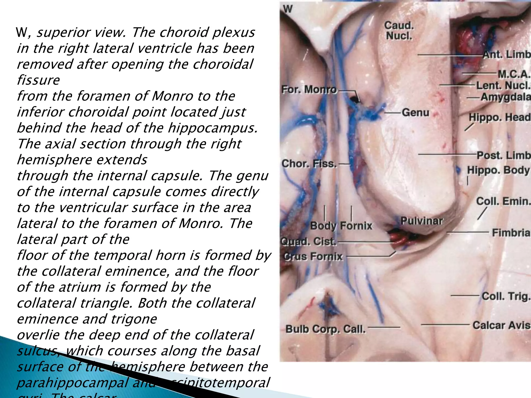 Anatomy of lateral ventricle | PPTX
