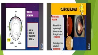 ANATOMY OF LENS AND FACTORS AFFECTING LENS TRANSPARENCY (1) - Copy.pptx