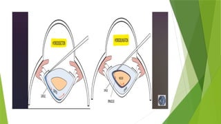 ANATOMY OF LENS AND FACTORS AFFECTING LENS TRANSPARENCY (1) - Copy.pptx