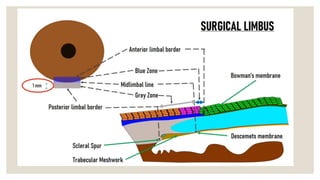 Tiansha Limbus Anatomy of limbus ,and there structures forming and depicting there ...