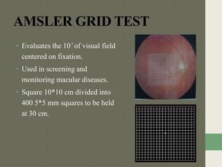 AMSLER GRID TEST
• Evaluates the 10 ̊ of visual field
centered on fixation.
• Used in screening and
monitoring macular diseases.
• Square 10*10 cm divided into
400 5*5 mm squares to be held
at 30 cm.
 