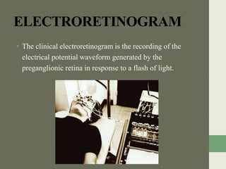 ELECTRORETINOGRAM
• The clinical electroretinogram is the recording of the
electrical potential waveform generated by the
preganglionic retina in response to a flash of light.
 