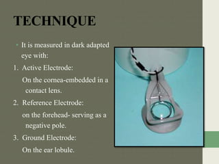 TECHNIQUE
• It is measured in dark adapted
eye with:
1. Active Electrode:
On the cornea-embedded in a
contact lens.
2. Reference Electrode:
on the forehead- serving as a
negative pole.
3. Ground Electrode:
On the ear lobule.
 