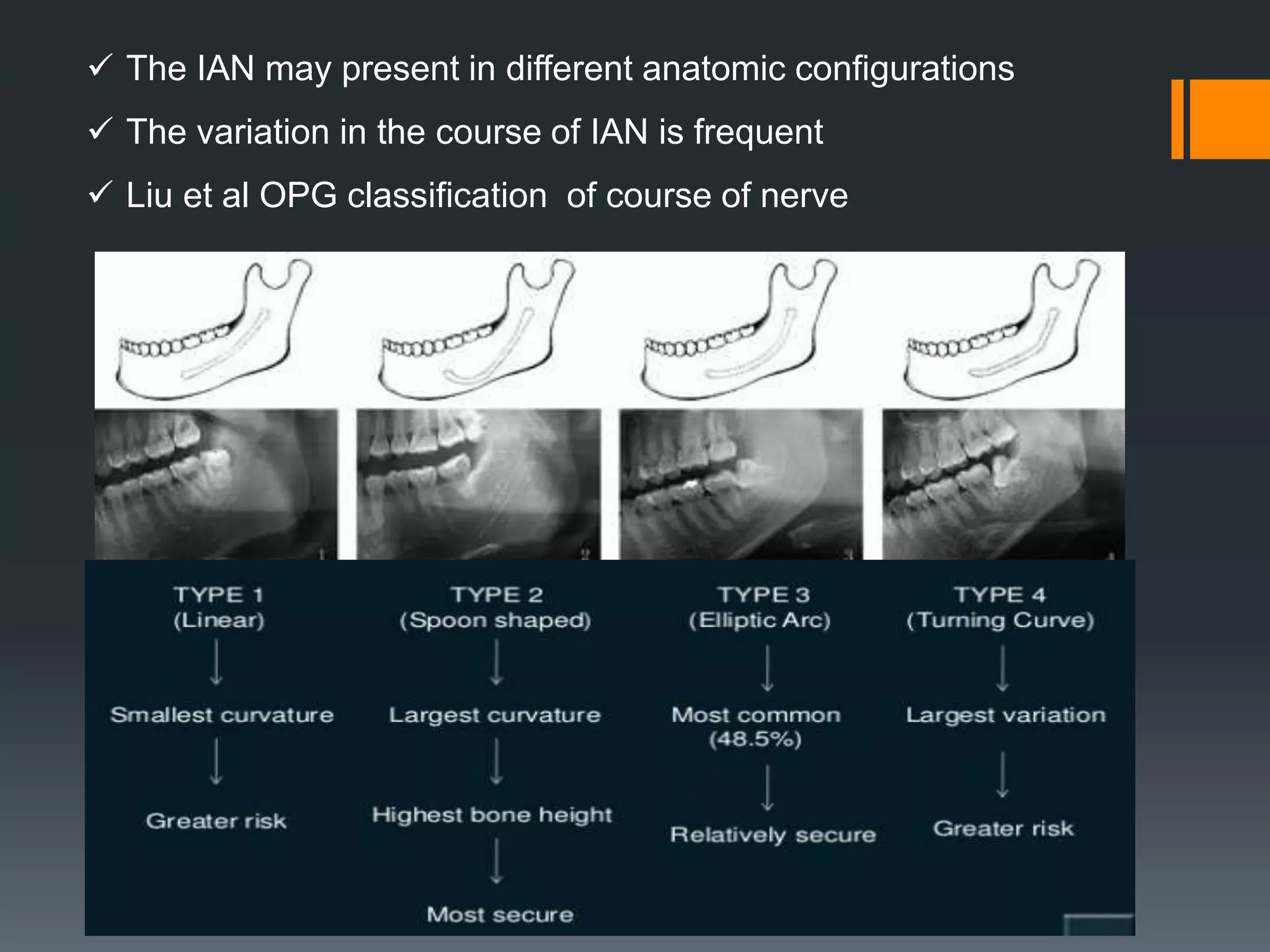  The IAN may present in different anatomic conﬁgurations
 The variation in the course of IAN is frequent
 Liu et al OPG classification of course of nerve
 