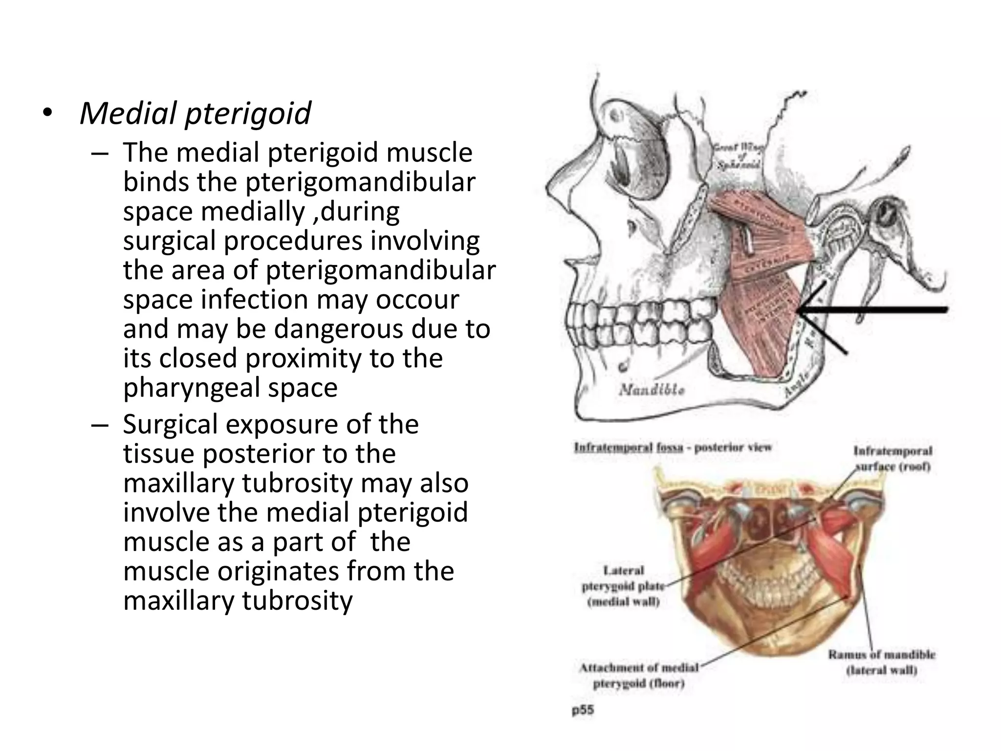• Medial pterigoid
– The medial pterigoid muscle
binds the pterigomandibular
space medially ,during
surgical procedures involving
the area of pterigomandibular
space infection may occour
and may be dangerous due to
its closed proximity to the
pharyngeal space
– Surgical exposure of the
tissue posterior to the
maxillary tubrosity may also
involve the medial pterigoid
muscle as a part of the
muscle originates from the
maxillary tubrosity
 
