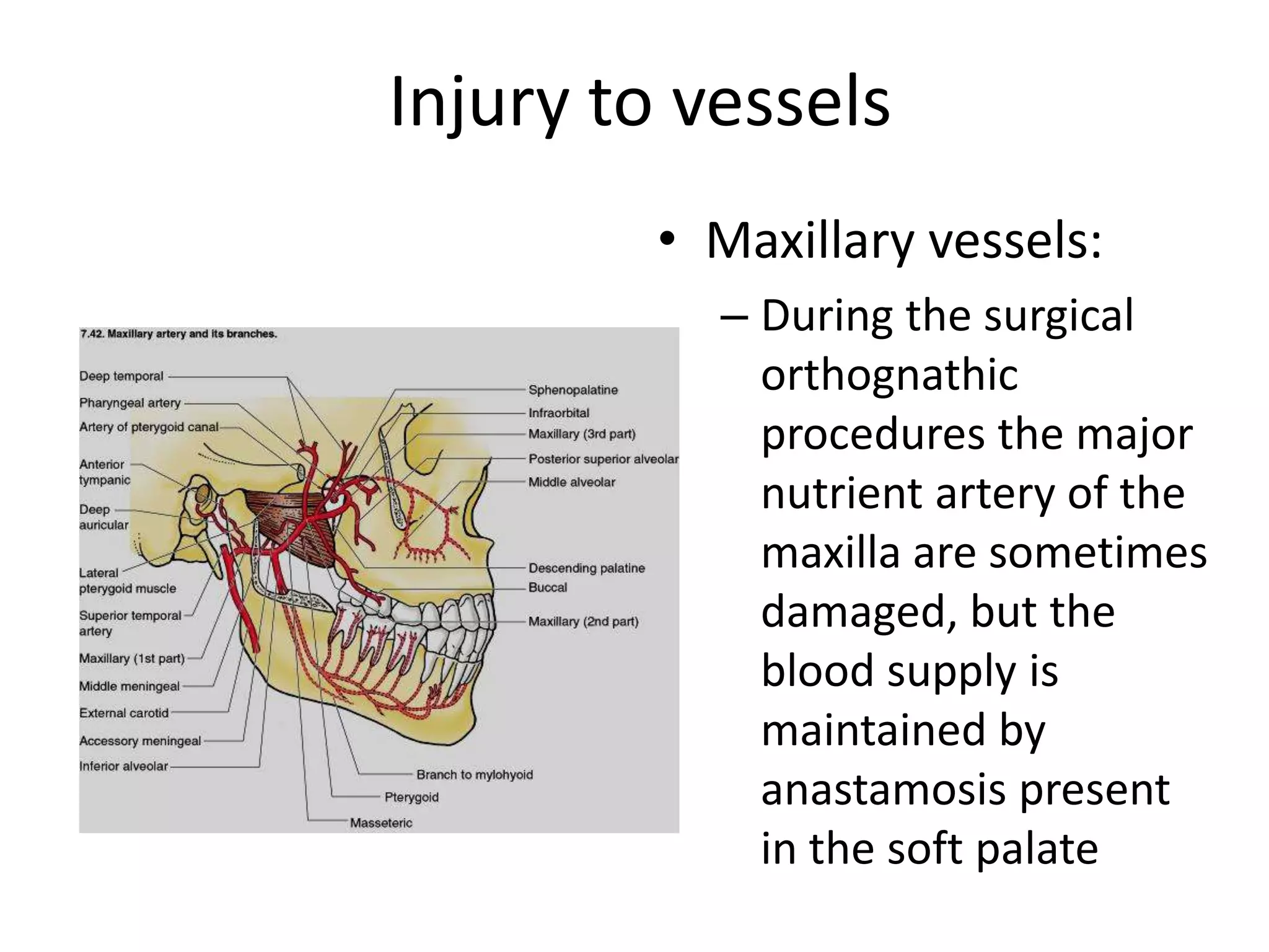 Injury to vessels
• Maxillary vessels:
– During the surgical
orthognathic
procedures the major
nutrient artery of the
maxilla are sometimes
damaged, but the
blood supply is
maintained by
anastamosis present
in the soft palate
 