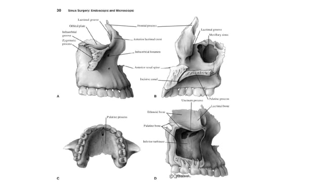 Embryology and Anatomy of Maxillary sinus | PPTX