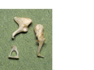 Anatomy of middle ear | PPTX