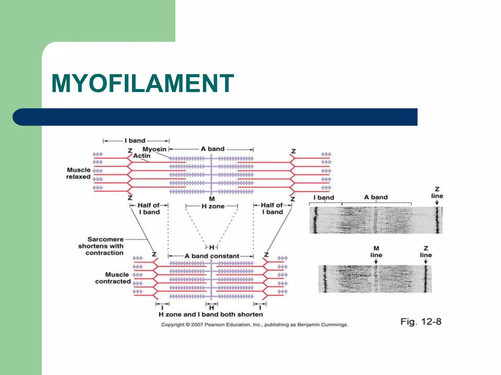 MYOFILAMENT
 