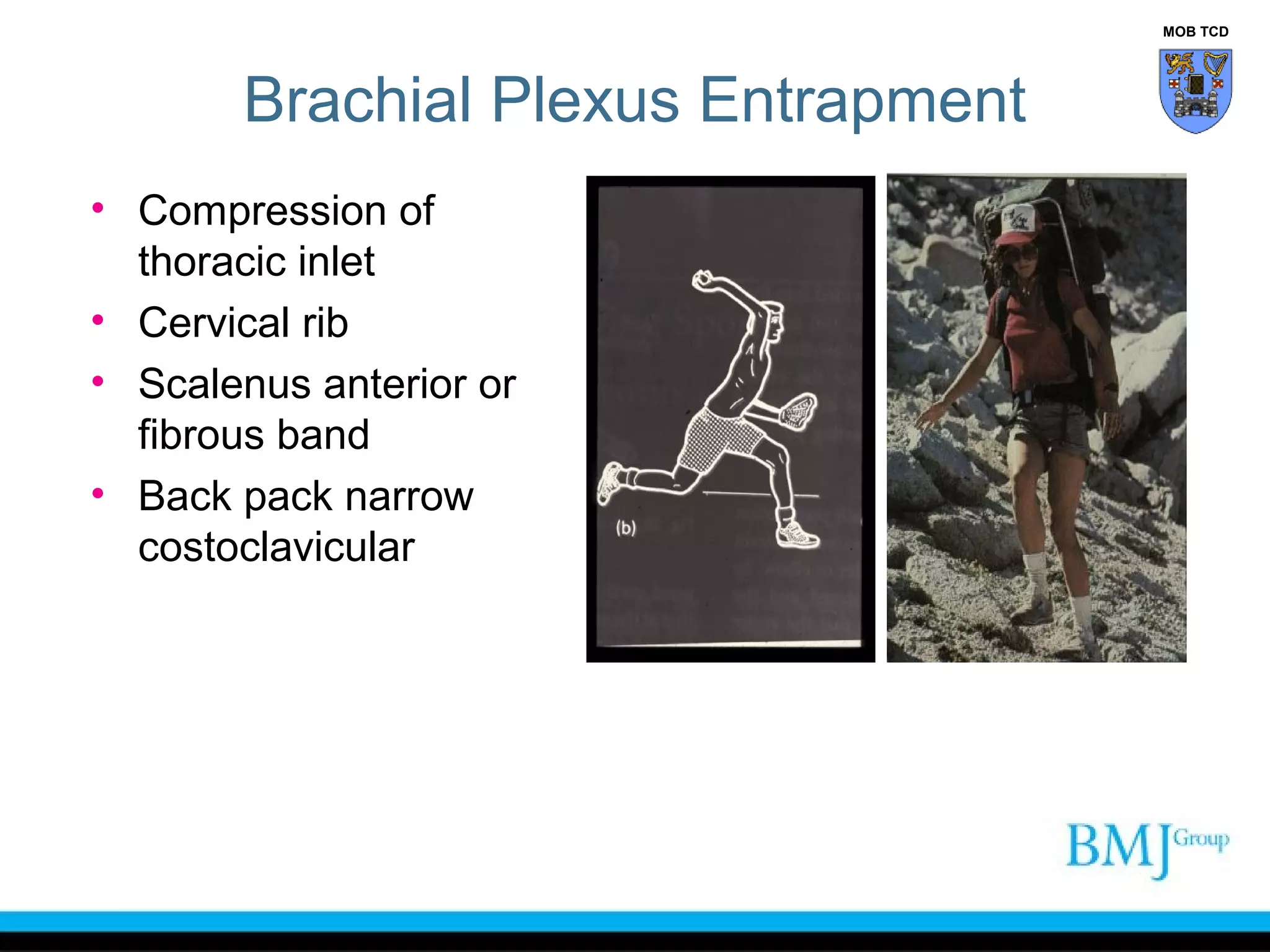 Anatomy of nerve injuries upper limb | PPT